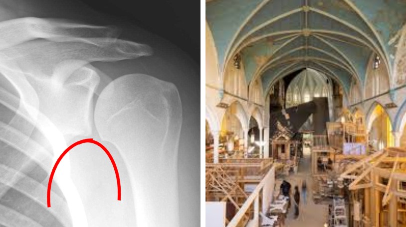 Architecture in the Shoulder and Elbow