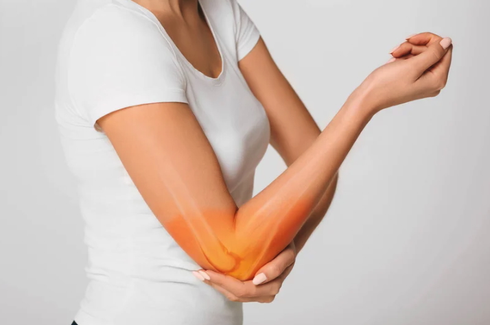 woman with injured elbow that may require surgery in New York