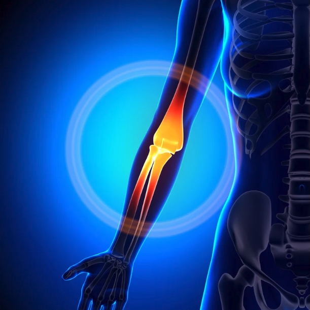 elbow surgery risks with replacement