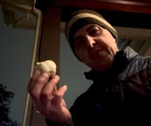 garlic analogy shoulder elbow surgeon new york