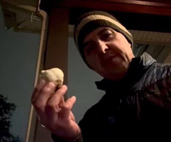 garlic analogy shoulder elbow surgeon new york